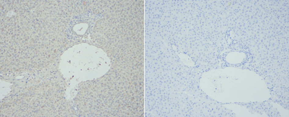 fig.2. 左图：superkine™ 增强型稀释液ihc验证的结果，右图：未加一抗的阴性对照。样本为小鼠肝组织。一抗：tnf-α多克隆抗（abp0127 ，1:200），二抗:山羊抗兔igg（a21020，1:300）。