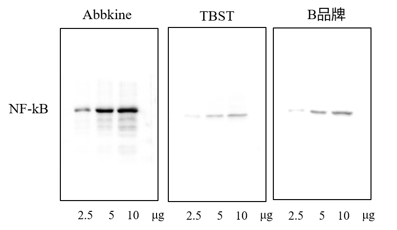 fig.1.superkine™ 增强型抗体稀释液（bmu103-cn）与普通抗体稀释液（tbst）以及同级竞品（b品牌）进行对比wb实验，显示superkine™ 稀释液信噪比更高。样本: hek293细胞； 一抗:小鼠抗nfkbp65单抗(abm0017，1：5000)；